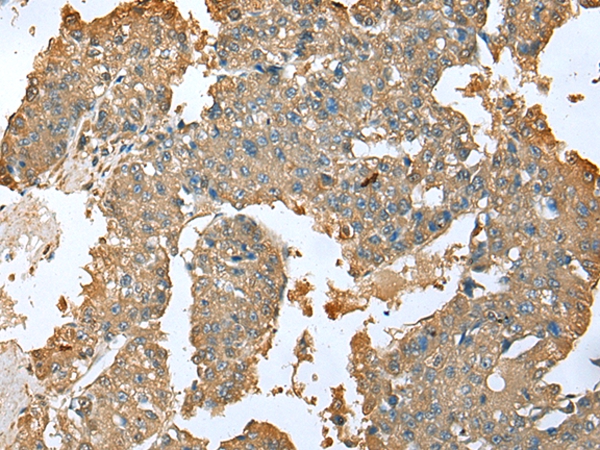 SFN Antibody