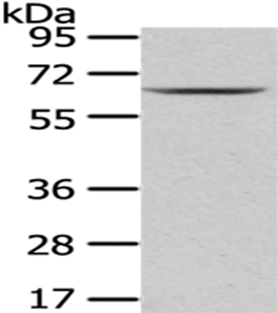 PKLR Antibody