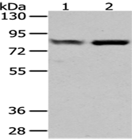 GUSB Antibody