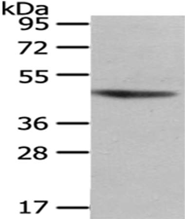 NHLRC1 Antibody