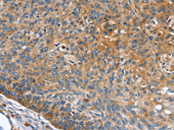INS Antibody