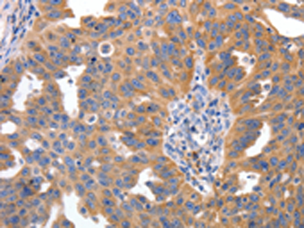 IRS2 Antibody