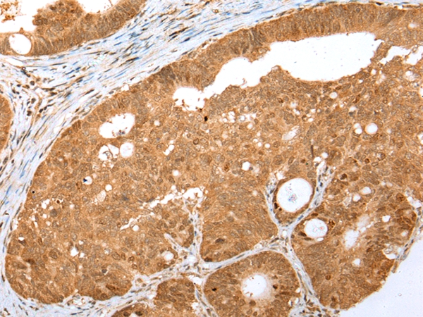 MKI67/ki67 Antibody