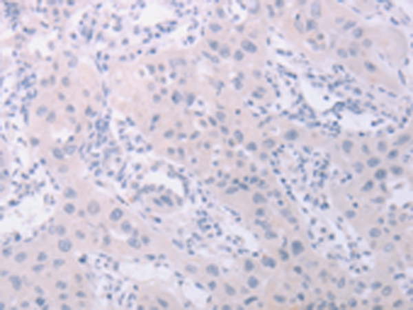 PKD2L1 Antibody