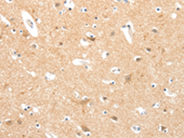 TIGAR Antibody