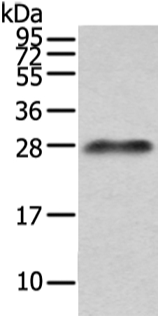 Lambda Light chain Antibody