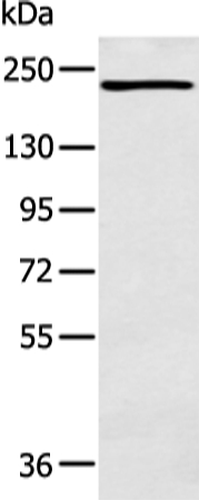NCOR2 Antibody