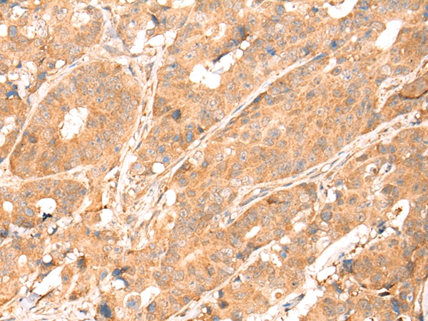ABCA10 Antibody