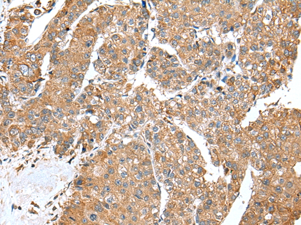 ACSL3 Antibody