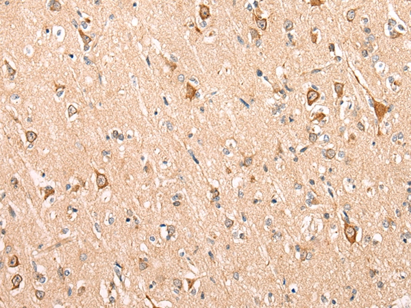 ADAM19 Antibody