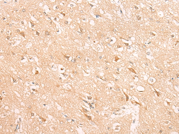 HIRA Antibody