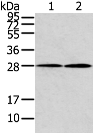 KCNMB1 Antibody