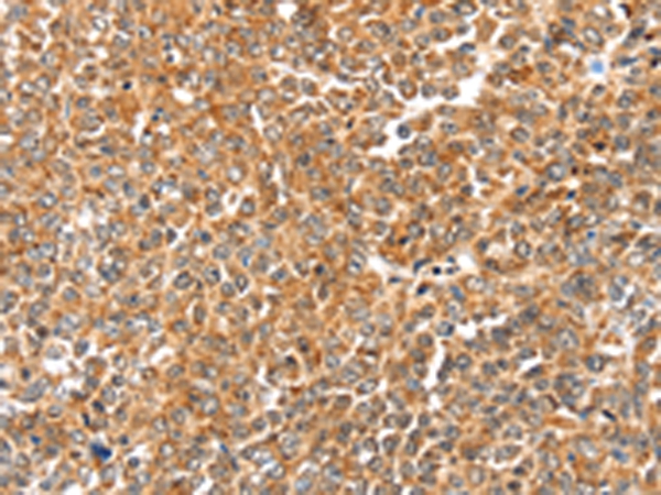 LOXL2 Antibody