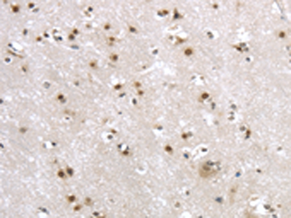 MRE11A Antibody