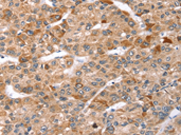 TBC1D1 Antibody