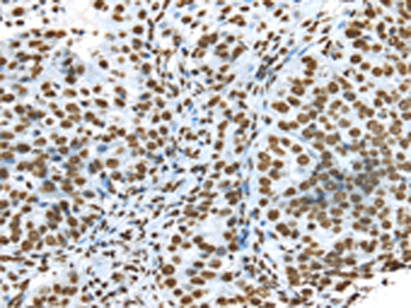 TRIM27 Antibody