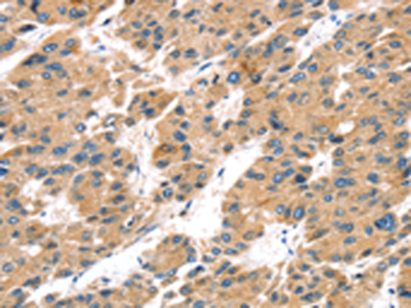 TRPV5 Antibody