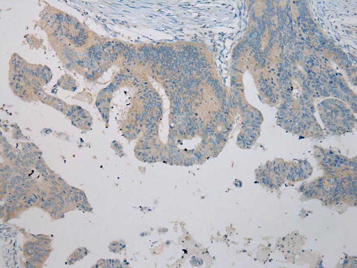 UBTD2 Antibody