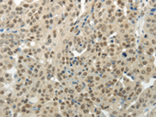 BAZ1B Antibody