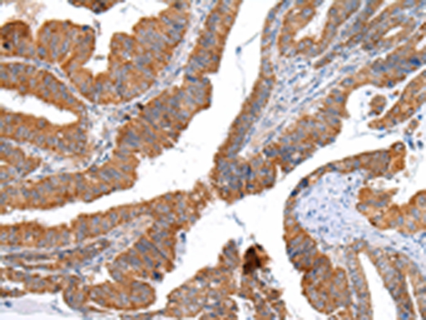 XKR4 Antibody