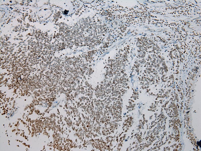 ZNF200 Antibody