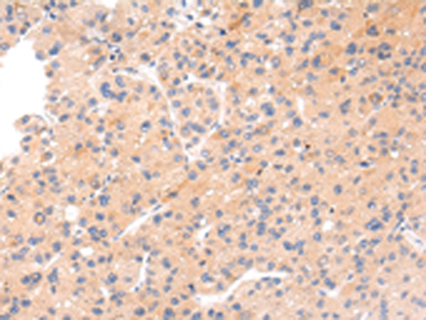 IKZF4 Antibody