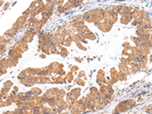 CASZ1 Antibody