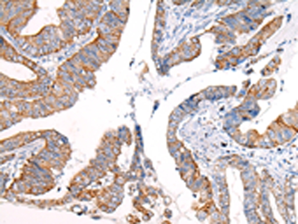 KRT7 Antibody