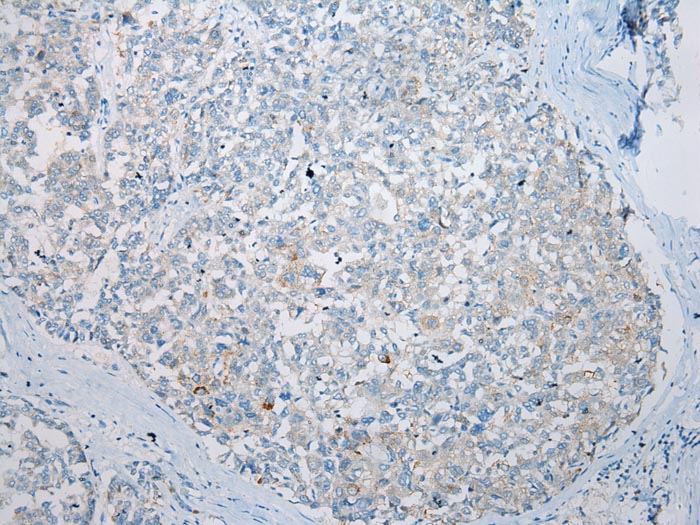 AQP7 Antibody