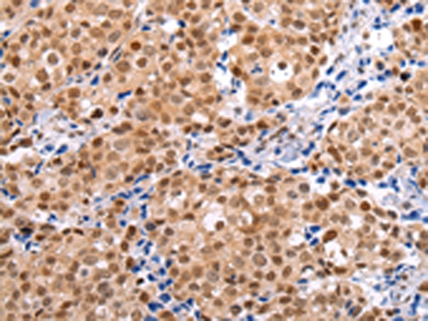 BRMS1 Antibody