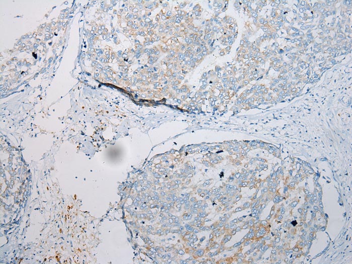 CCL7 Antibody