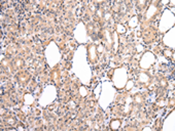 CDK8 Antibody