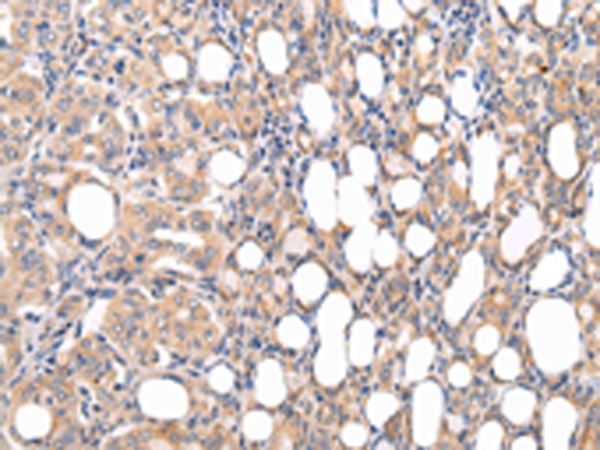 CMKLR1 Antibody