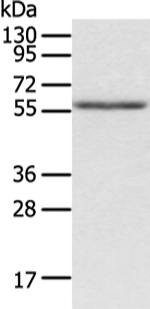 ACVRL1 Antibody