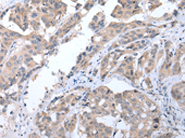 ALDH2 Antibody