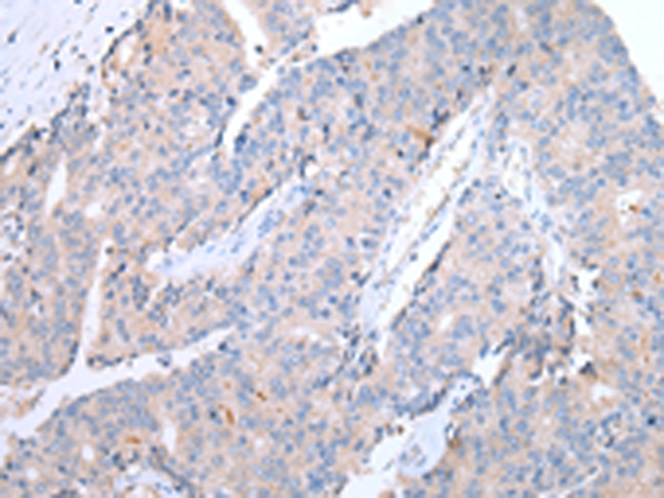 CCR10 Antibody