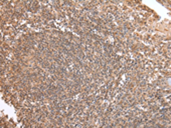 DVL1 Antibody