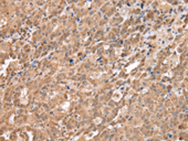 DDX58 Antibody