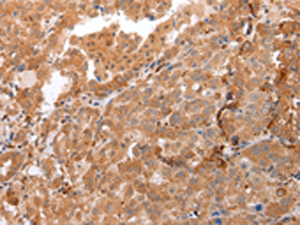 DEFB4A Antibody
