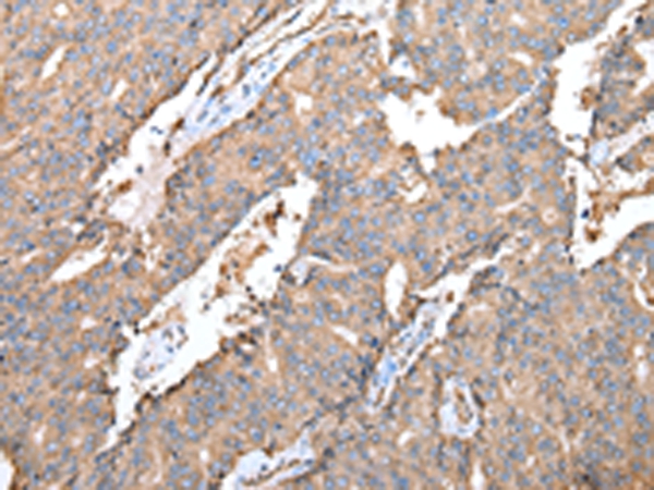 SPINK7 Antibody