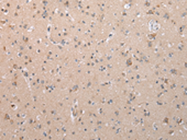COL15A1 Antibody