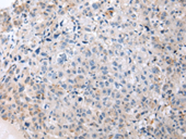ENPP1 Antibody
