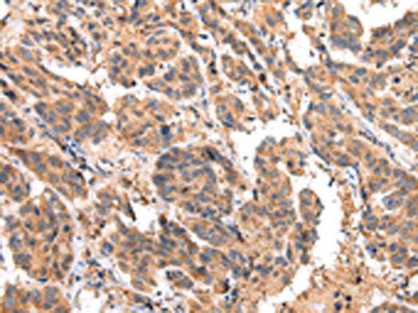 EPHA2 Antibody
