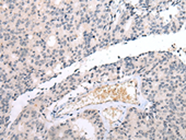 DUSP9 Antibody