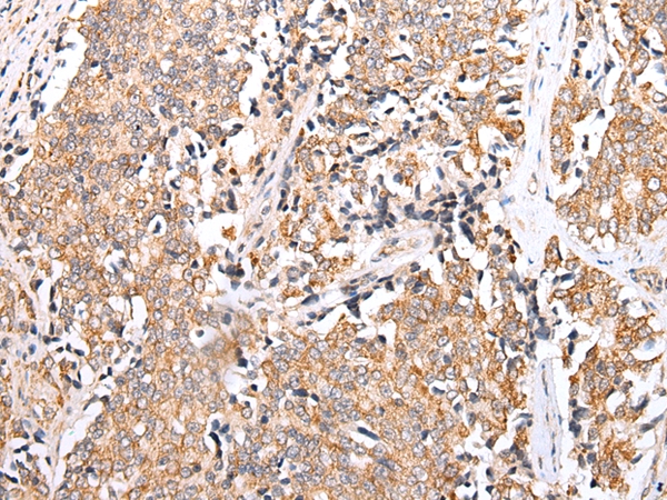 PPP1R15A Antibody