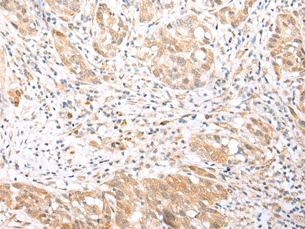 BCL2L11 Antibody