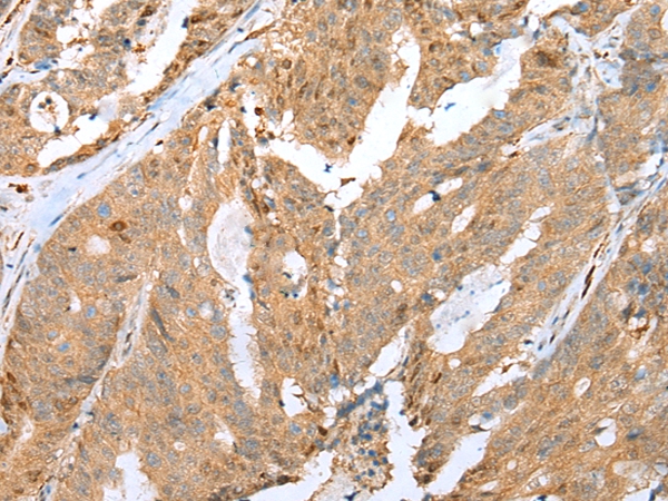 CCNG2 Antibody