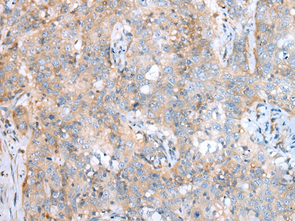 SDCCAG8 Antibody