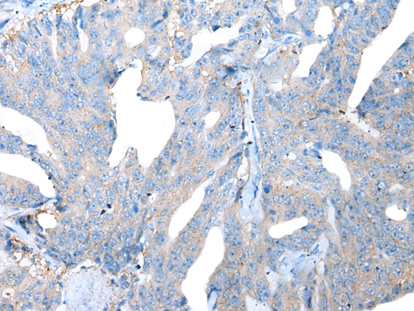 LAMP1 Antibody