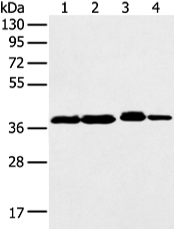 DCX Antibody